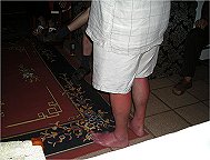 Fritz hat sich die Beine in der Sonne verbrannt.